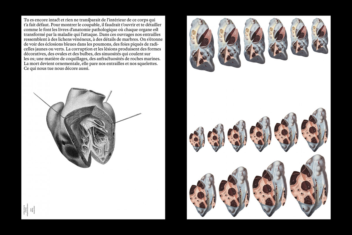 101-cltn-traversee_anatomique-96-03