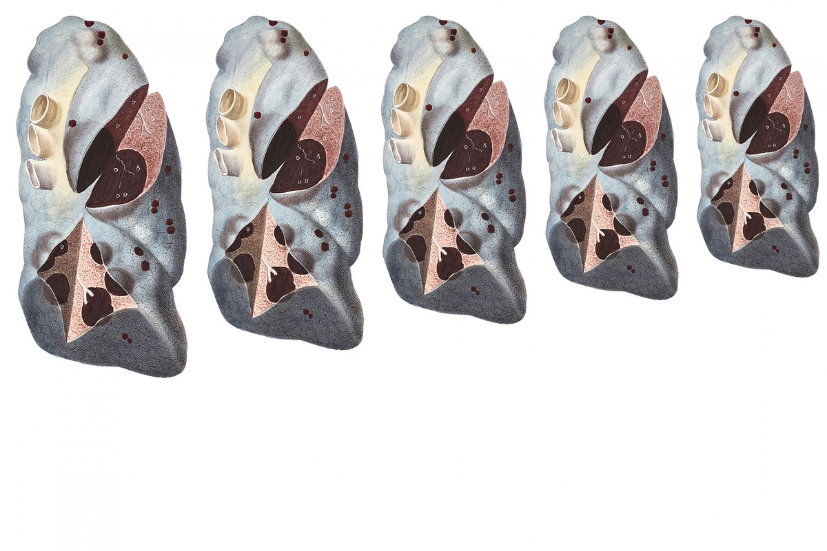 101-cltn-traversee_anatomique-96-01